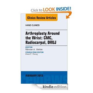 Arthroplasty Around the Wrist: CME, RADIOCARPAL, DRUJ, An Issue of Hand Clinics, (The Clinics: Orthopedics) eBook: Marwan A. Wehbe: Kindle Store