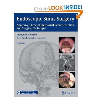 Endoscopic Sinus Surgery: Anatomy, Three Dimensional Reconstruction, and Surgical Technique (9781604066876): Peter John Wormald: Books