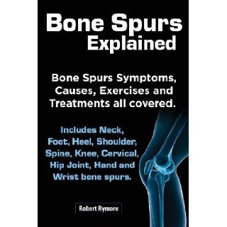 Bone Spurs Explained. Bone Spurs Symptoms, Causes, Exercises and Treatments All Covered. Includes Neck, Foot, Heel, Shoulder, Spine, Knee, Cervical, H: Robert Rymore: 9781909151499: Books
