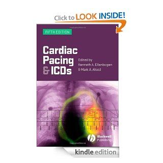 Cardiac Pacing and ICDs eBook Kenneth A. Ellenbogen, Mark A. Wood Kindle Store