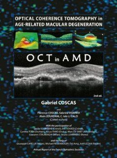 Optical Coherence Tomography in Age Related Macular Degeneration (OCT in AMD): 9783642101816: Medicine & Health Science Books @
